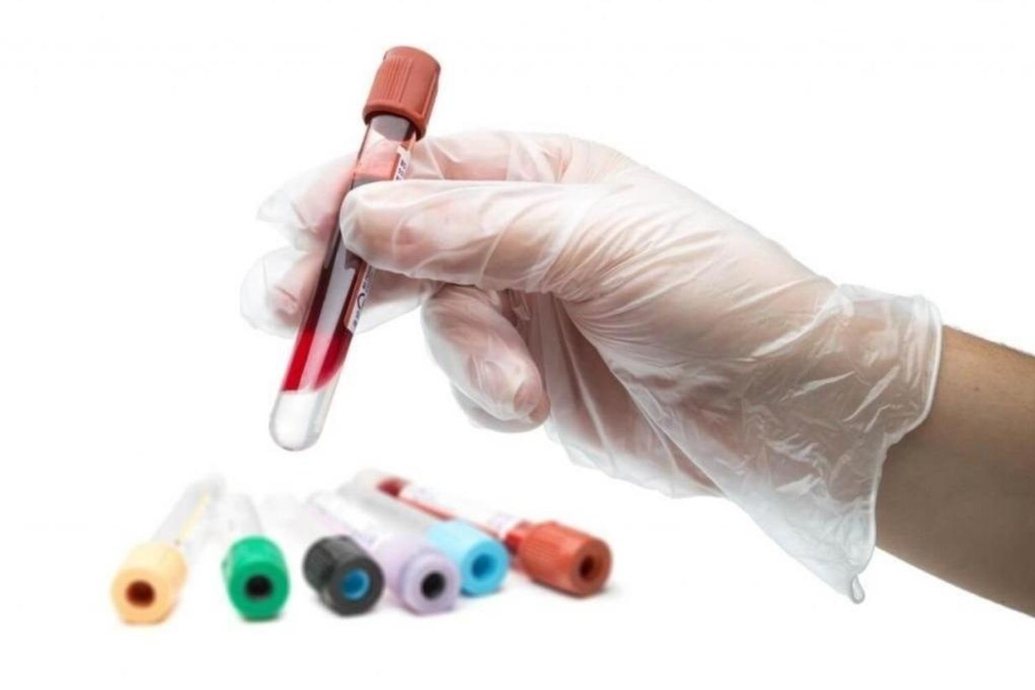 Биохимический анализ крови