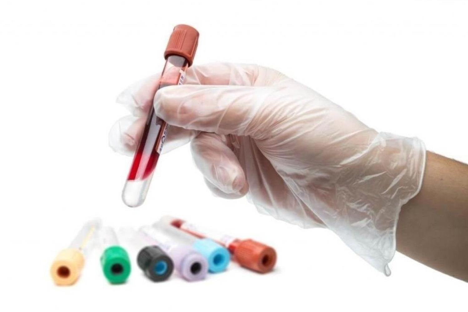 Биохимический анализ крови